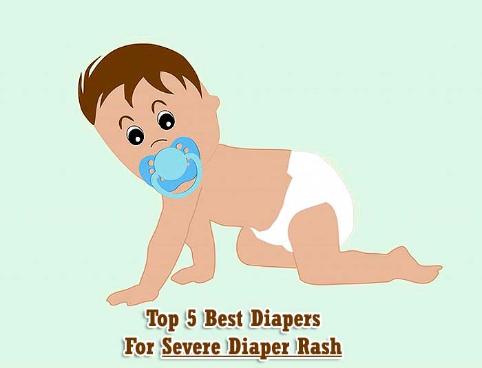 best diapers for diaper rash